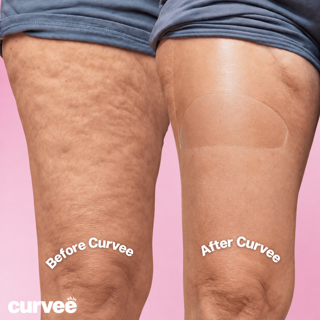 Curvee Thigh → ירכיים
