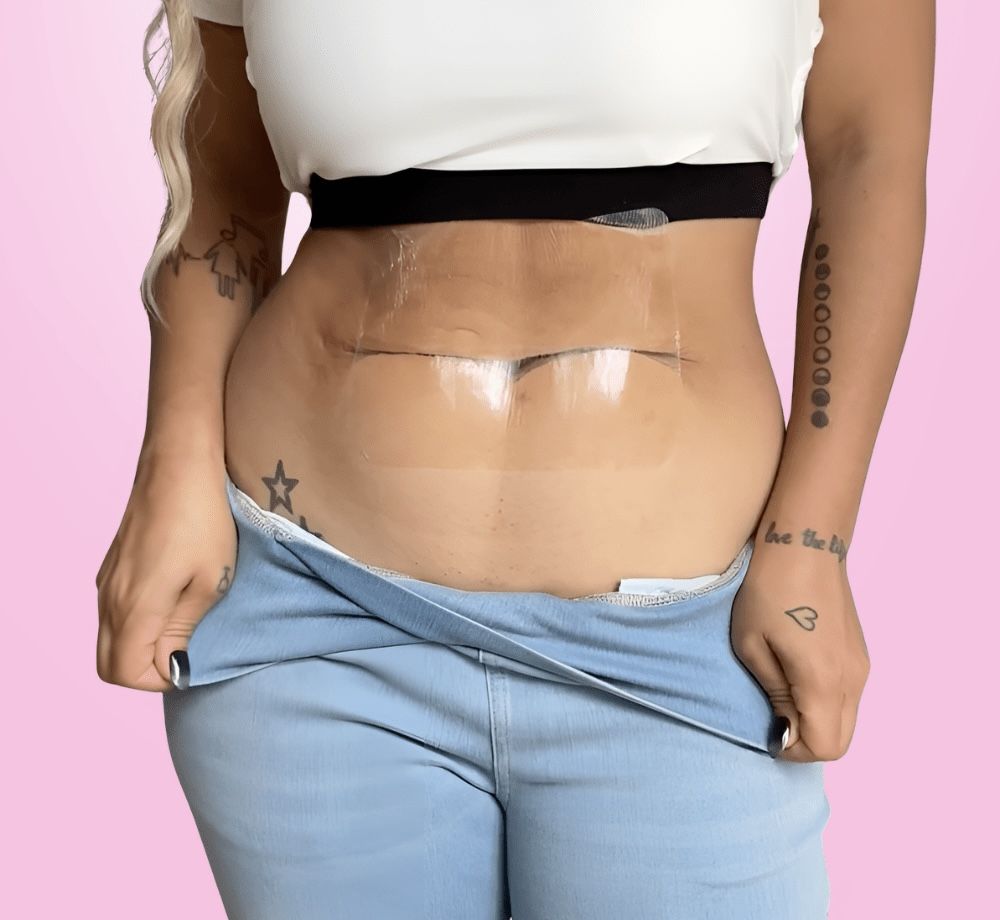 Curvee Tummy → בטן